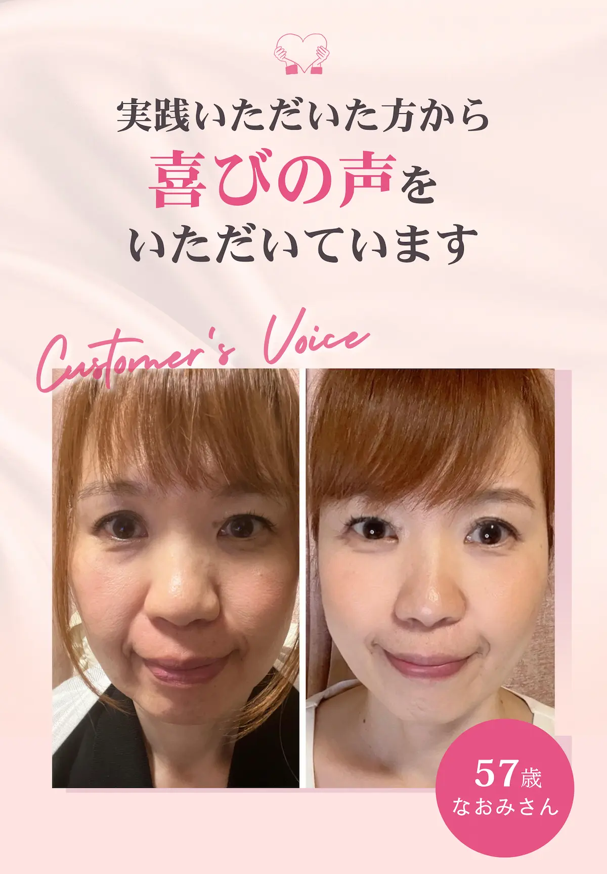 57歳 なおみさん ビフォーアフター