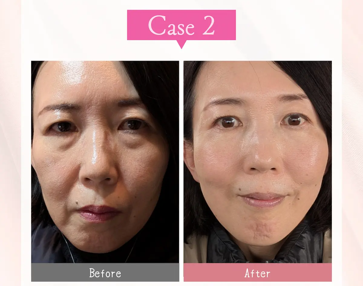 体験レッスン参加者 Case 2 ビフォーアフター